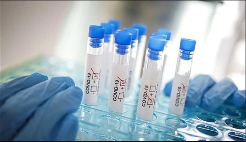Koronavirüs testi yapmaya yetkili olan kurum sonuçları gizlemiş