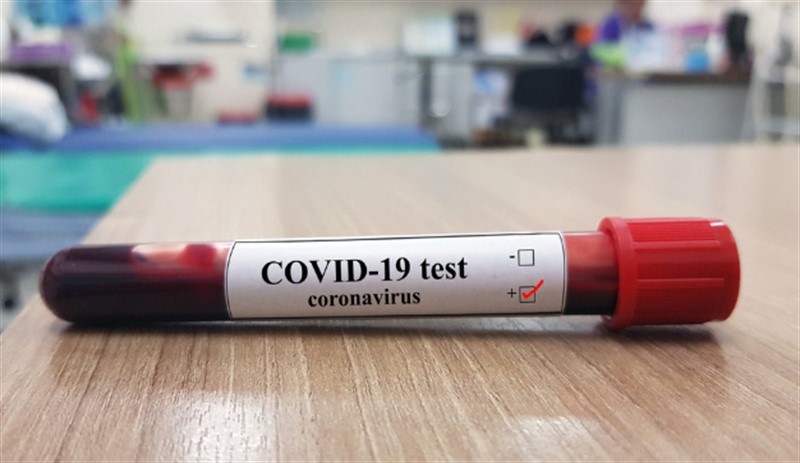 İtalyan ve İspanyol doktorlar yeni bir Covid-19 belirtisi tespit etti