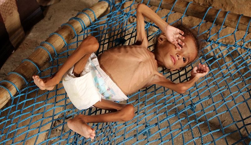 Oxfam raporu: Salgına bağlı artan açlık nedeniyle ölenlerin sayısı hastalıktan ölenleri geçebilir