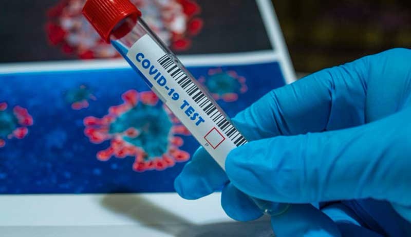 Coronavirus: Vaka sayısı 32 milyonu aştı