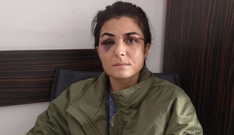 HDP Kadın Meclisi: Melek İpek öz savunma hakkını kullanmıştır, derhal serbest bırakılmalı