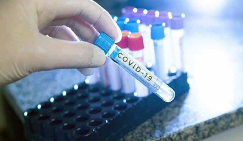 İspatlandı: Coronavirus, erkeklerde kalıcı kısırlığa neden oluyor