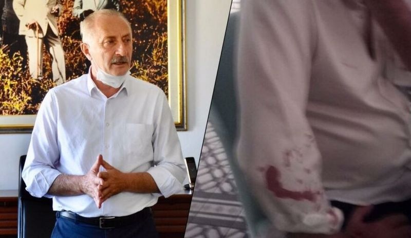 CHP’li belediye başkanına saldırıda 7 gözaltı: Saldırganlar 'tanıdık' çıktı