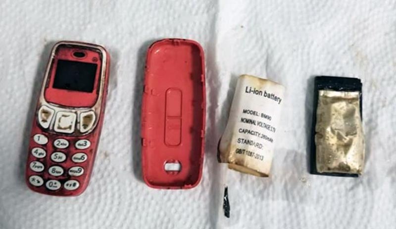 Bir kişinin midesinden Nokia 3310 çıkarıldı