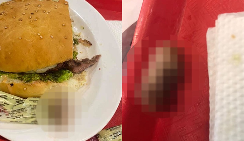 Hamburgerin içinden insan parmağı çıktı