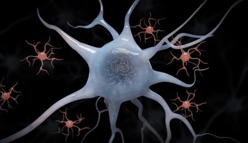 Mikroglia hücrelerinin Alzheimer'a umut olabilecek bir işlevi bulundu