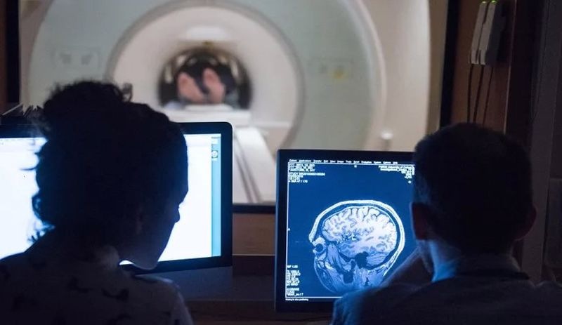 Araştırma: Covid-19 geçirenlerin beyin boyutunda küçülme gözlemlendi
