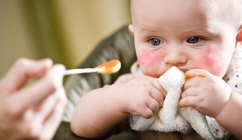 İnek sütü, yumurta ve buğday: Çocuklardaki 'gıda alerjisi haritası'