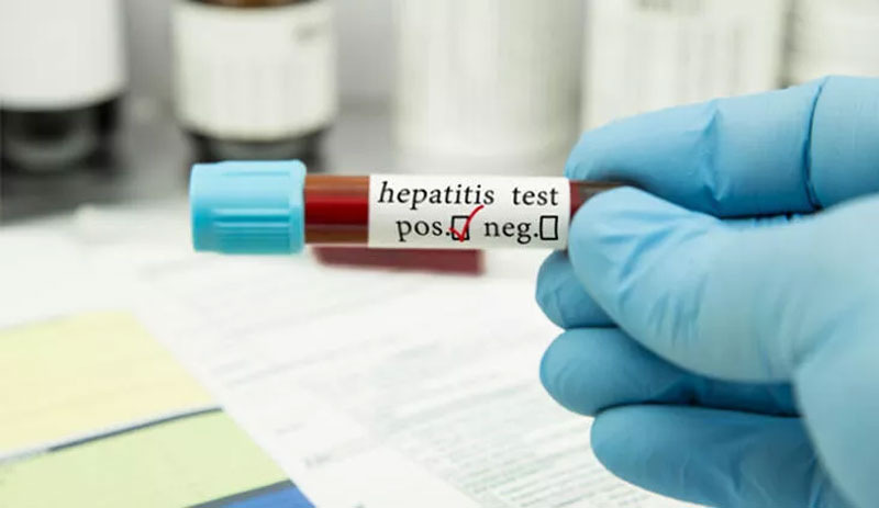 Küresel salgın riski artıyor: 'Gizemli' hepatit virüsü Kanada'da da görüldü