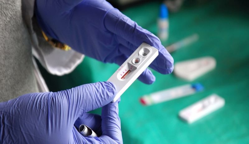 Covid-19 için kullanılan hızlı testler, cinsel yolla bulaşan hastalıklar için de kullanılabilir
