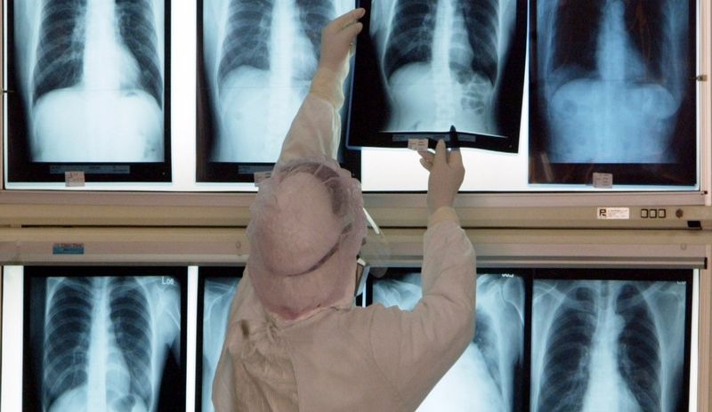 Yapay zeka, X-Ray görüntülerinden insanların ırkını tahmin ediyor; bunun riskleri olabilir