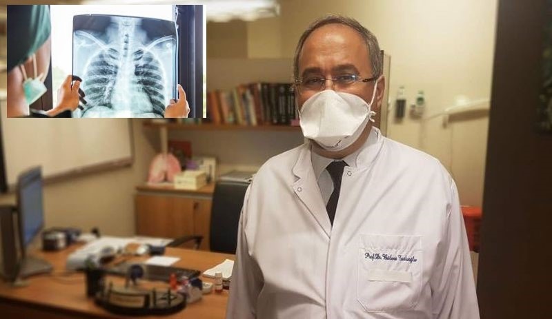 Prof. Dr. Tutluoğlu: ‘Resmi’ rakamlara göre akciğer tutulumu oranı yüzde 5 ancak gerçek oran yüzde 70