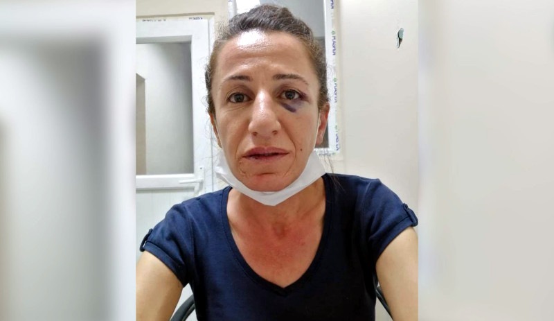 HDP'li Çetin'e köpekle işkence eden polis için ‘basit yaralama’dan dava