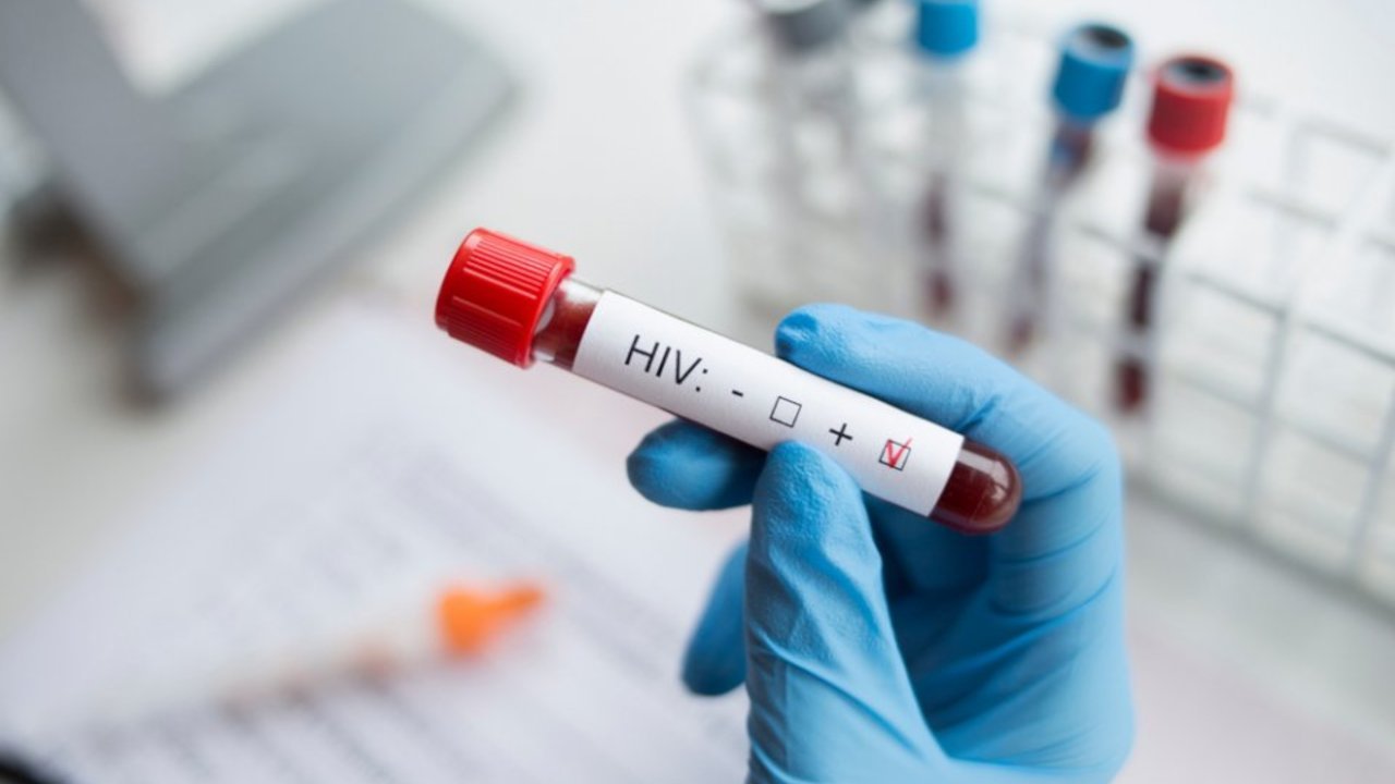 Prof. Dr. Şener: Tüm dünyada devam eden sessiz bir 'HIV pandemisi' var
