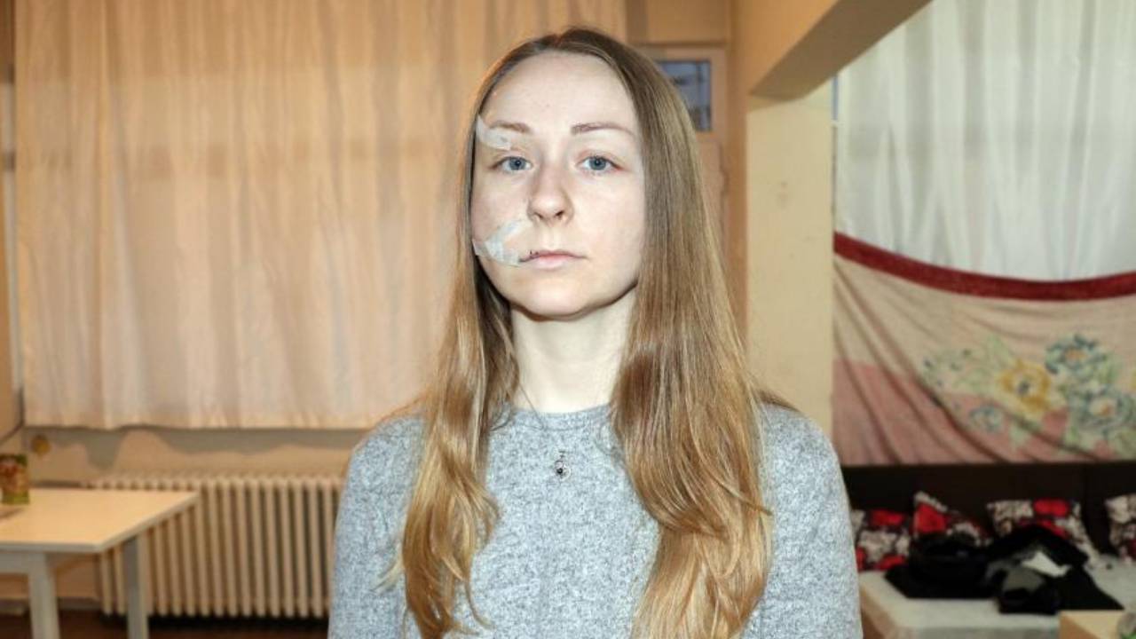 Boşanmak isteyen Anna Butim'in yüzünü falçatayla yaralayan erkek tahliye edildi