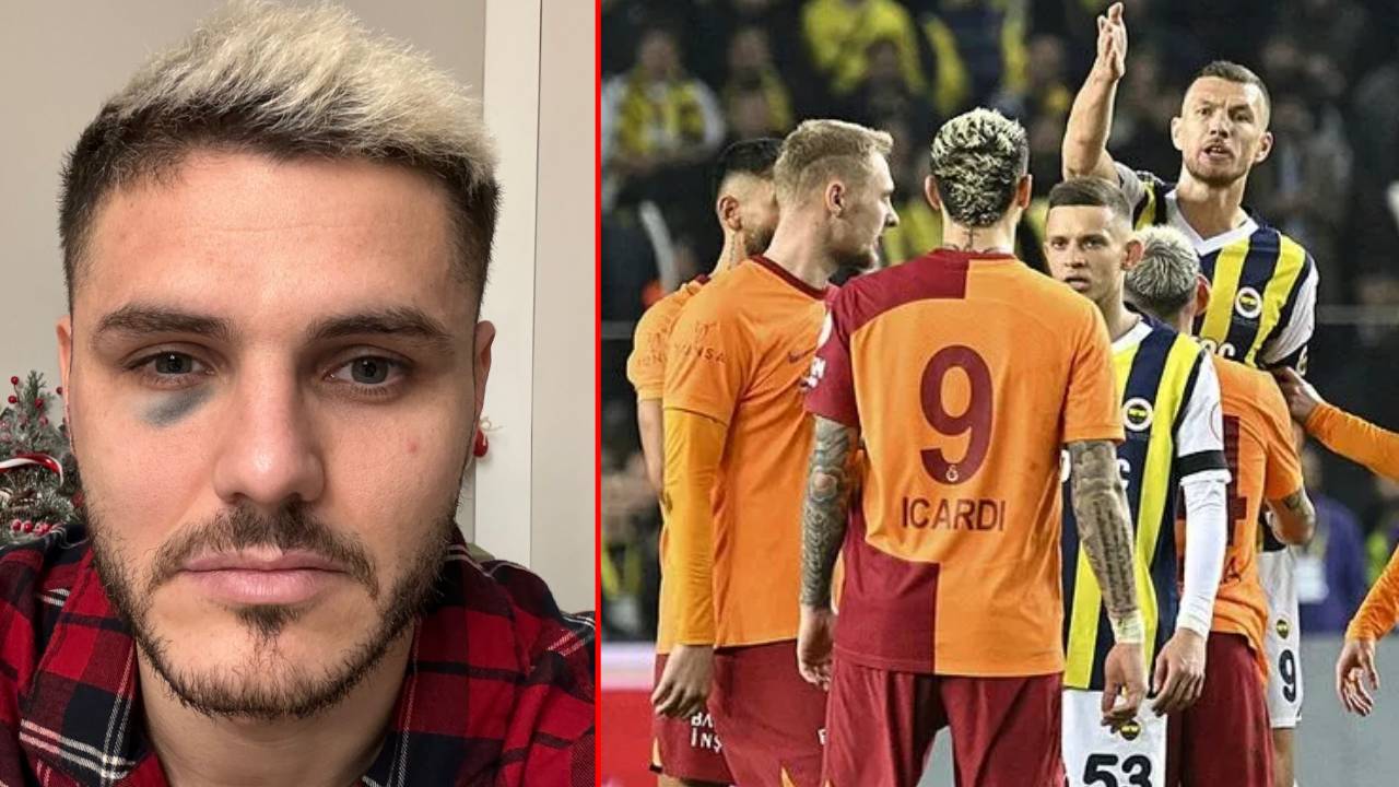 Galatasaray, Icardi'nin son halini paylaştı, Fenerbahçe'den yanıt geldi