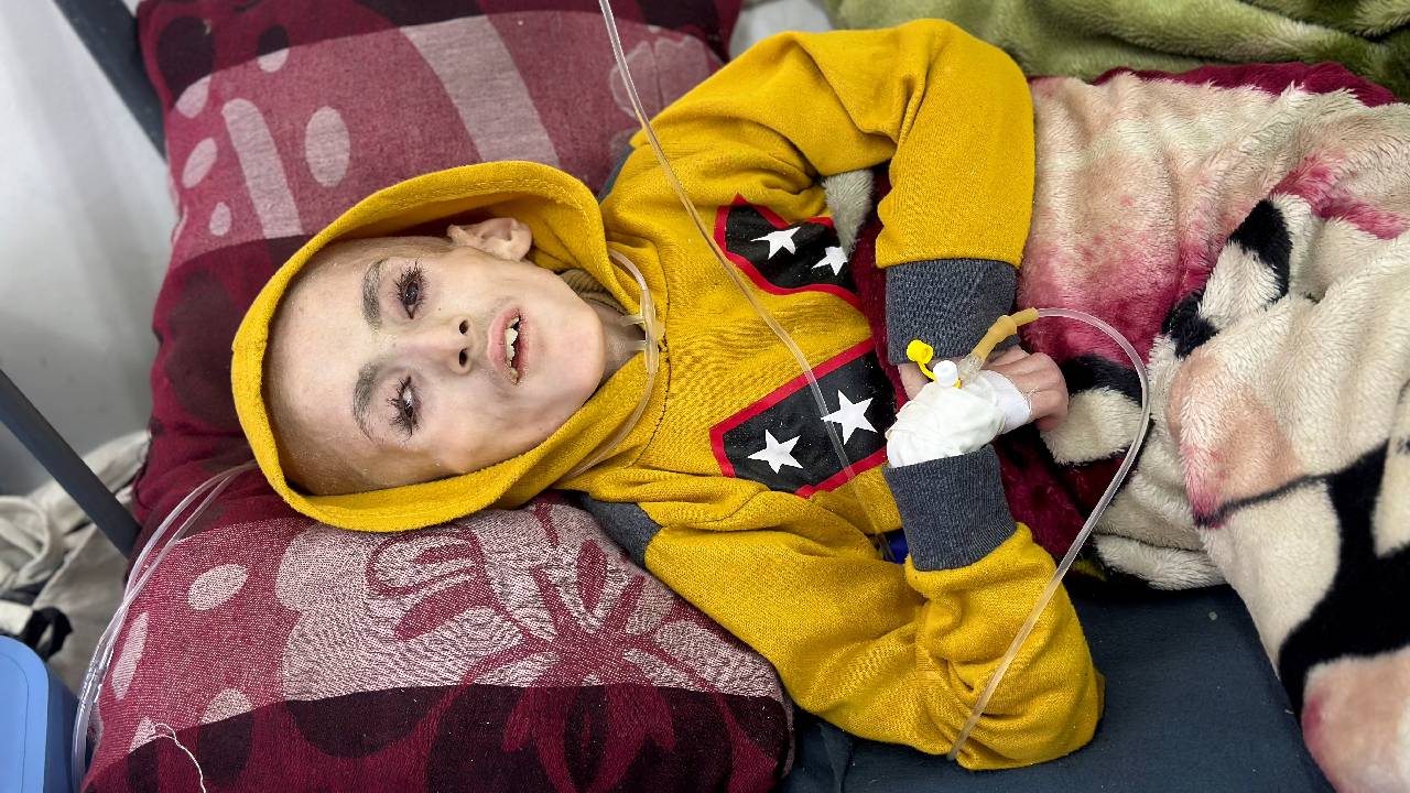 Reuters'de Gazze'deki bir deri bir kemik çocukların görüntüleri, DSÖ'den 'Filistinli çocuklar açlıktan ölüyor' uyarısı