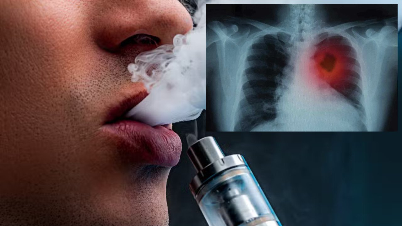 Elektronik sigara uyarısı: 'İleride çok daha genç nüfusta kanser görebiliriz'
