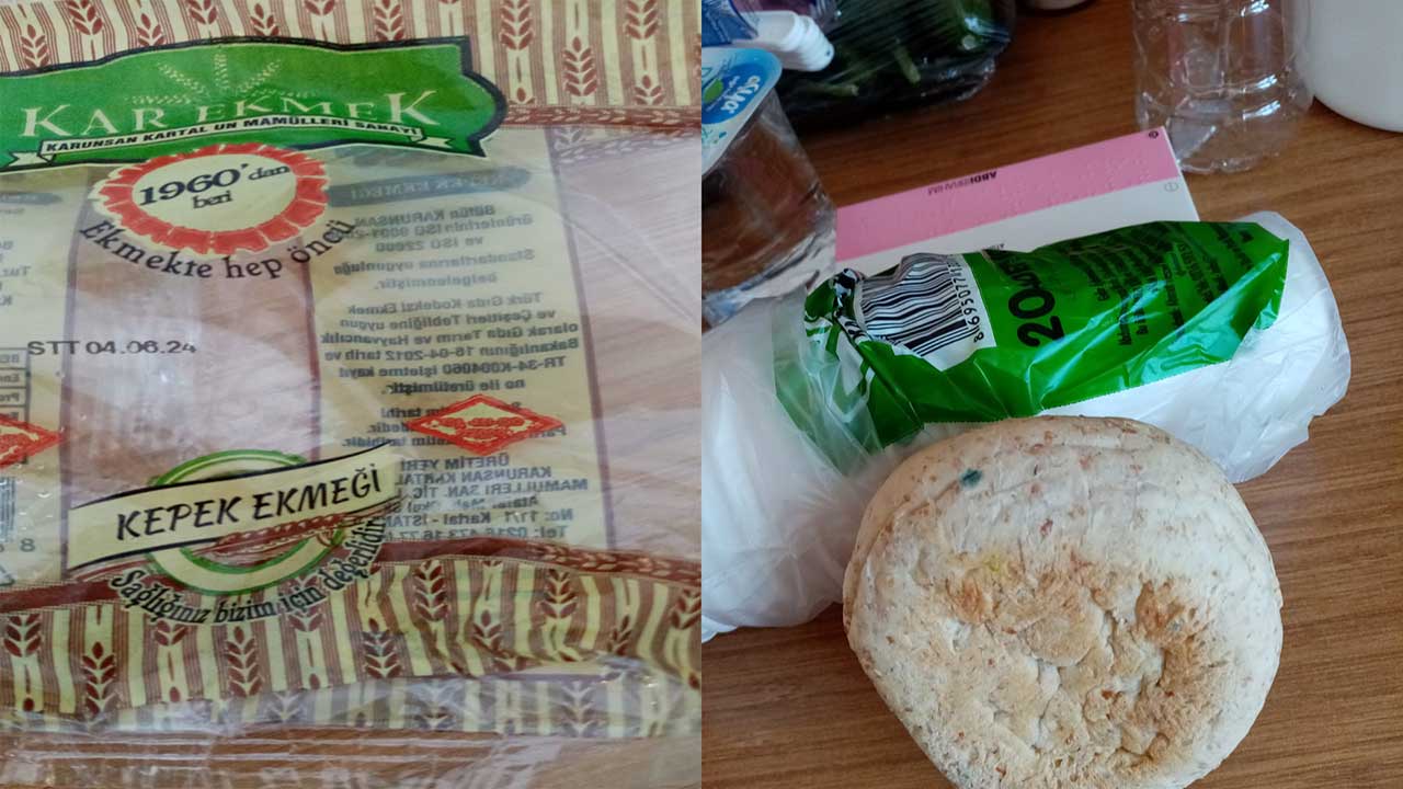'Devlet hastanesinde, hastaya tarihi geçmiş küflü ekmek verildi' iddiası