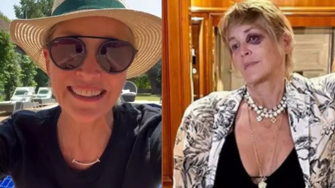 Sharon Stone, Bodrum'da kaza geçirdi