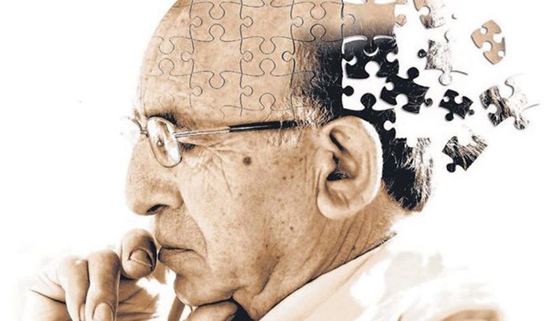 'Alzheimer kontrol edilebilecek'