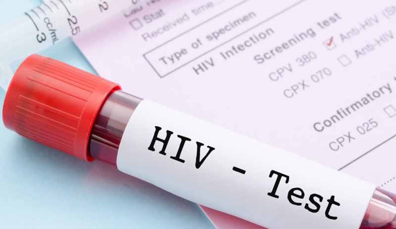 AIDS hastaları için yeni bir umut