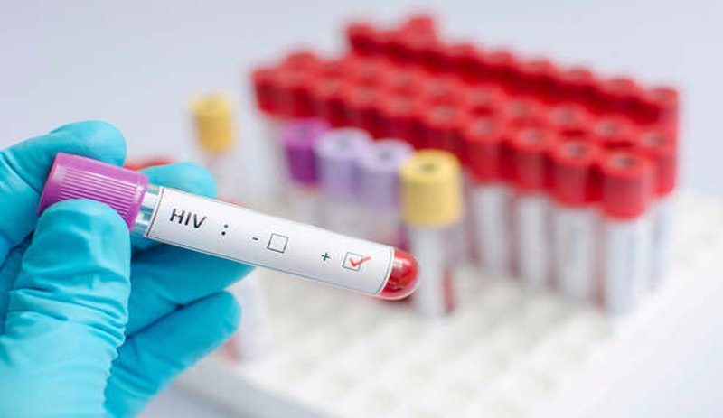 HIV virüsü artık hemen öldüremiyor