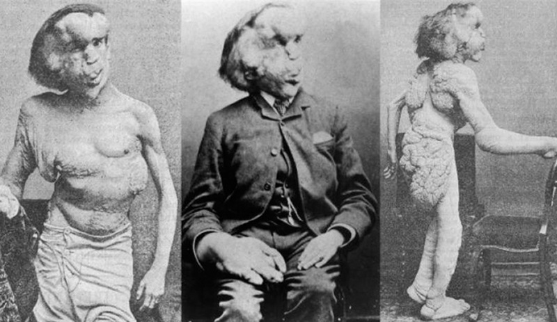 Fil Adam Joseph Merrick'in mezarı bulundu iddiası