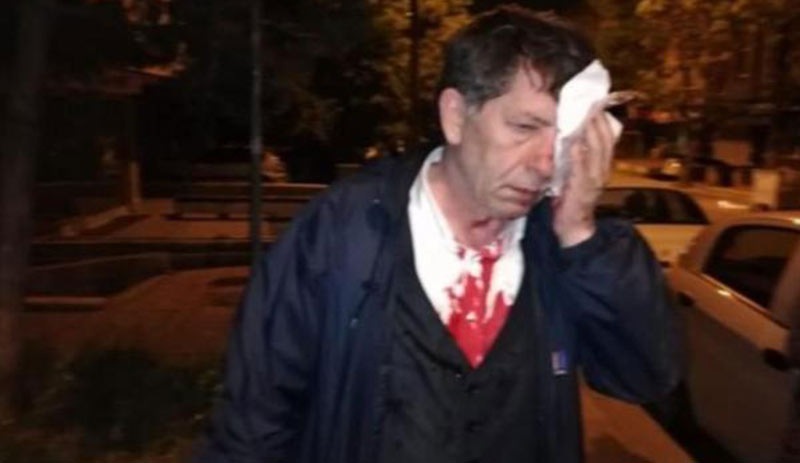 Gazeteci Demirağ'a saldıranları savcılık serbest bıraktı