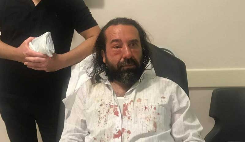 Metin Bozkurt'a saldırı anı kamerada