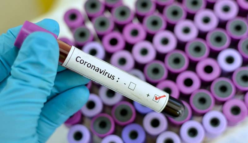 İran’dan açıklama: 2 kişide koronavirüs tespit edildi