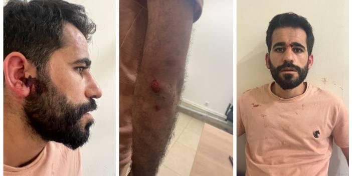 Avukat Kandemir: İstanbul Emniyet Müdürlüğü'nde polisler tarafından öldüresiye dövüldük