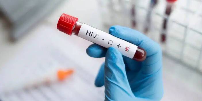 UNAIDS: Dünya genelinde 9,3 milyon kişi HIV tedavisine erişemiyor